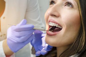 6 consejos si llevas ortodoncia